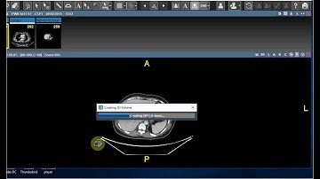 Image Fusion - Saince Merge PACS