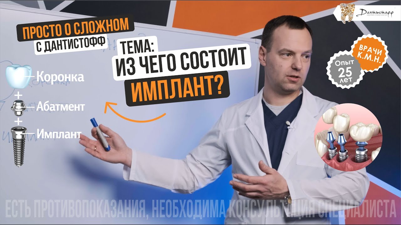 Из чего состоит зубной имплант? Просто о сложном с Дантистофф! - YouTube