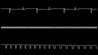 HIDE! [60Hz] (C64 Songs)