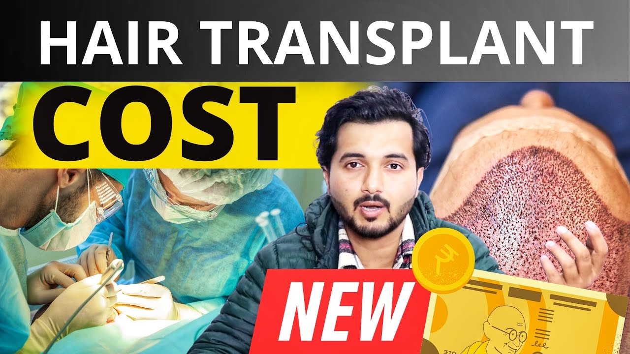 Hair Transplant Cost In India | Cost Of My Hair Transplant | Low Vs. High Cost Hair Transplant