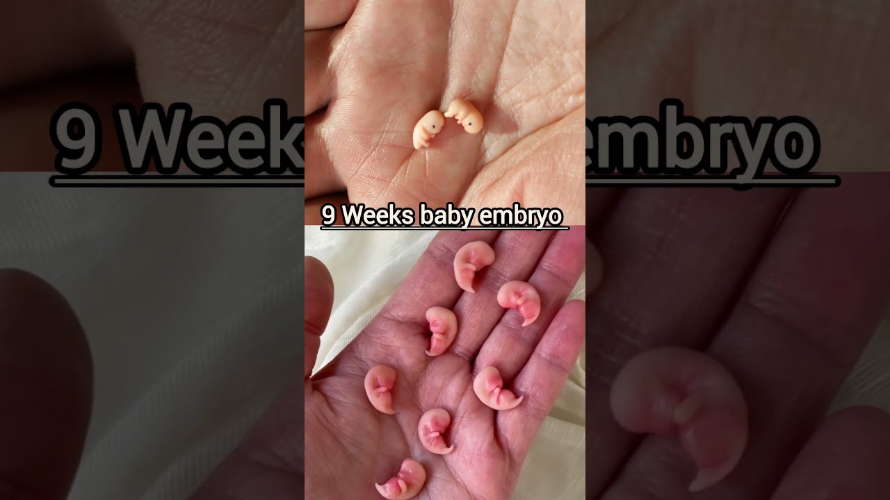 6 Weeks Baby Embryo Development Babydevelopment 6weeks 6weeksbabyembryo