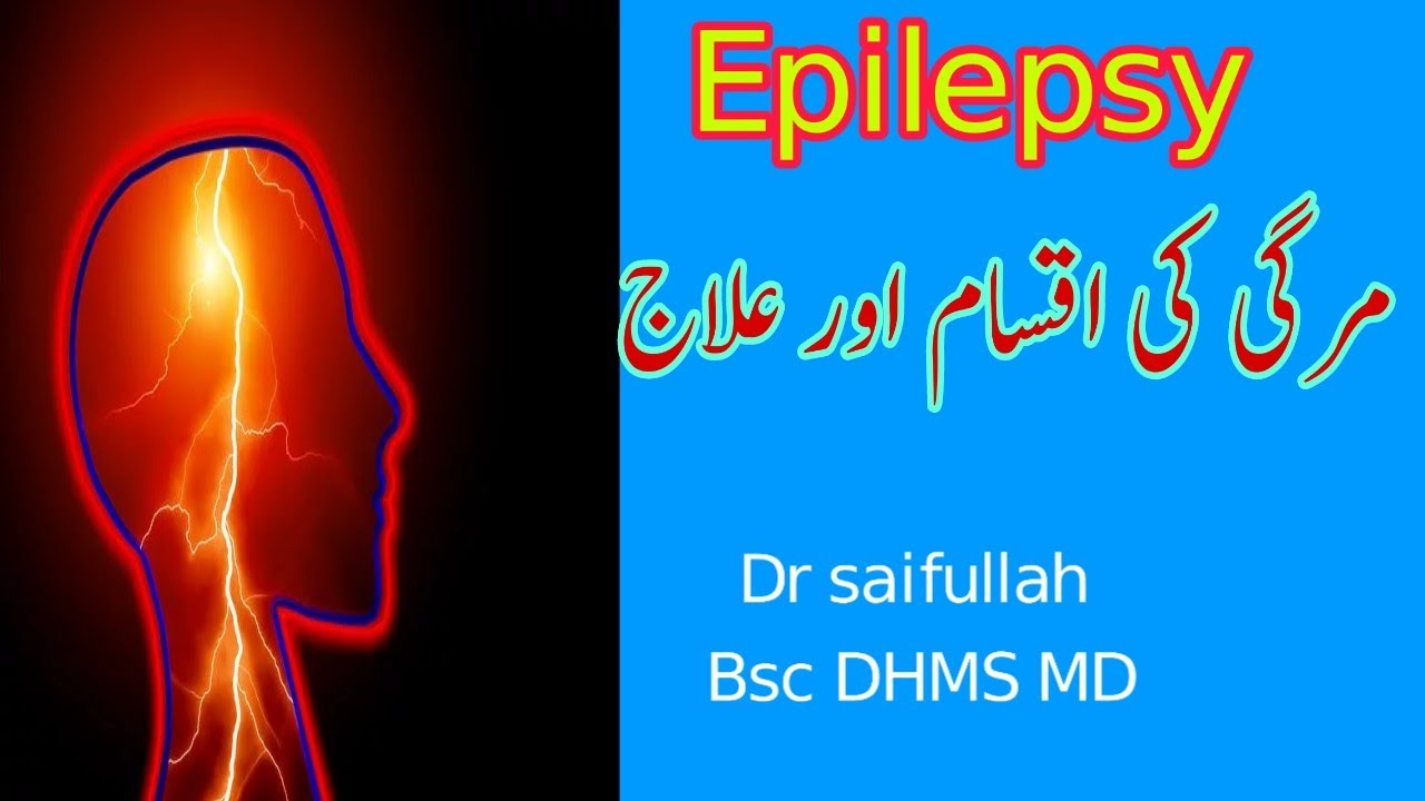 How to treat epilepsy /homeopathic medicine for epilepsy 