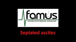 Septated Ascites