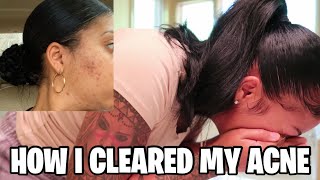 MY SKIN CARE ROUTINE! How I cleared my acne