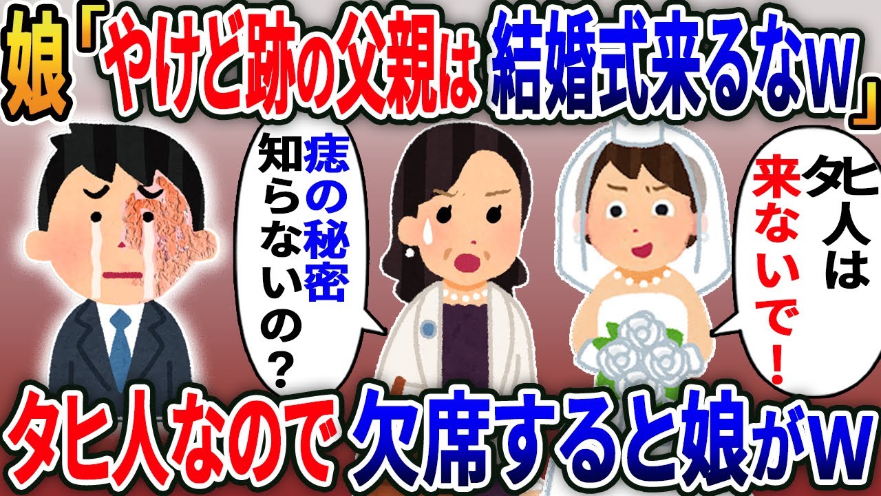 愛娘の結婚式に出席しようとしたら「やけど跡の親父はタヒんだことにしてるから来るな」と追い返された→嫁「あなた知らないの？」娘「え？」タヒ人なので黙って出ていくと娘がw【2ｃｈ修羅場スレ・ゆっくり解説】