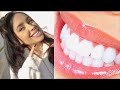 DIY INSTANT TEETH WHITENING (100% Works) | How To Whiten Teeth At Home for Cheap & Naturally