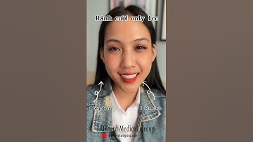 Tiêm rãnh cười trẻ hóa gương mặt là có thật