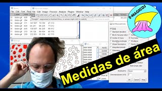Medidas de área com ImageJ / FIJI screenshot 4