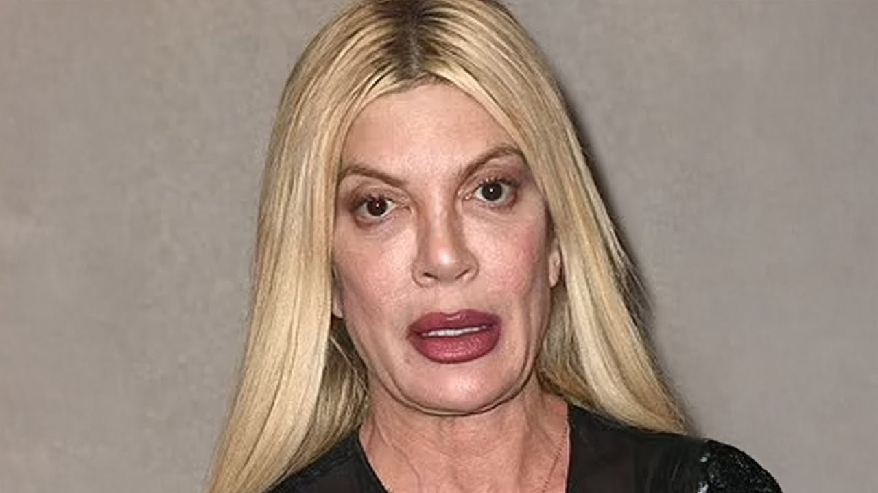 NEW Photos Show Celebs Who Look SICK After Using Ozempic