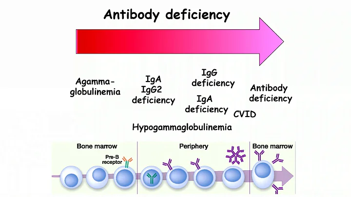 Common Variable Immune Deficiency (CVID)