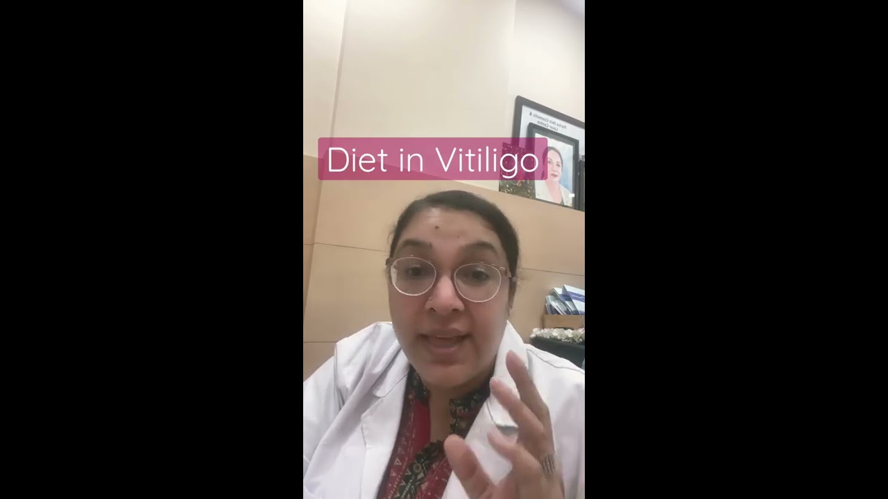 Diet In Vitiligo Day Treatment Vitamin C Food