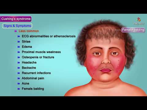Cushing Syndrome - causes, symptoms, diagnosis, treatment, pathology Usmle step 1 videos
