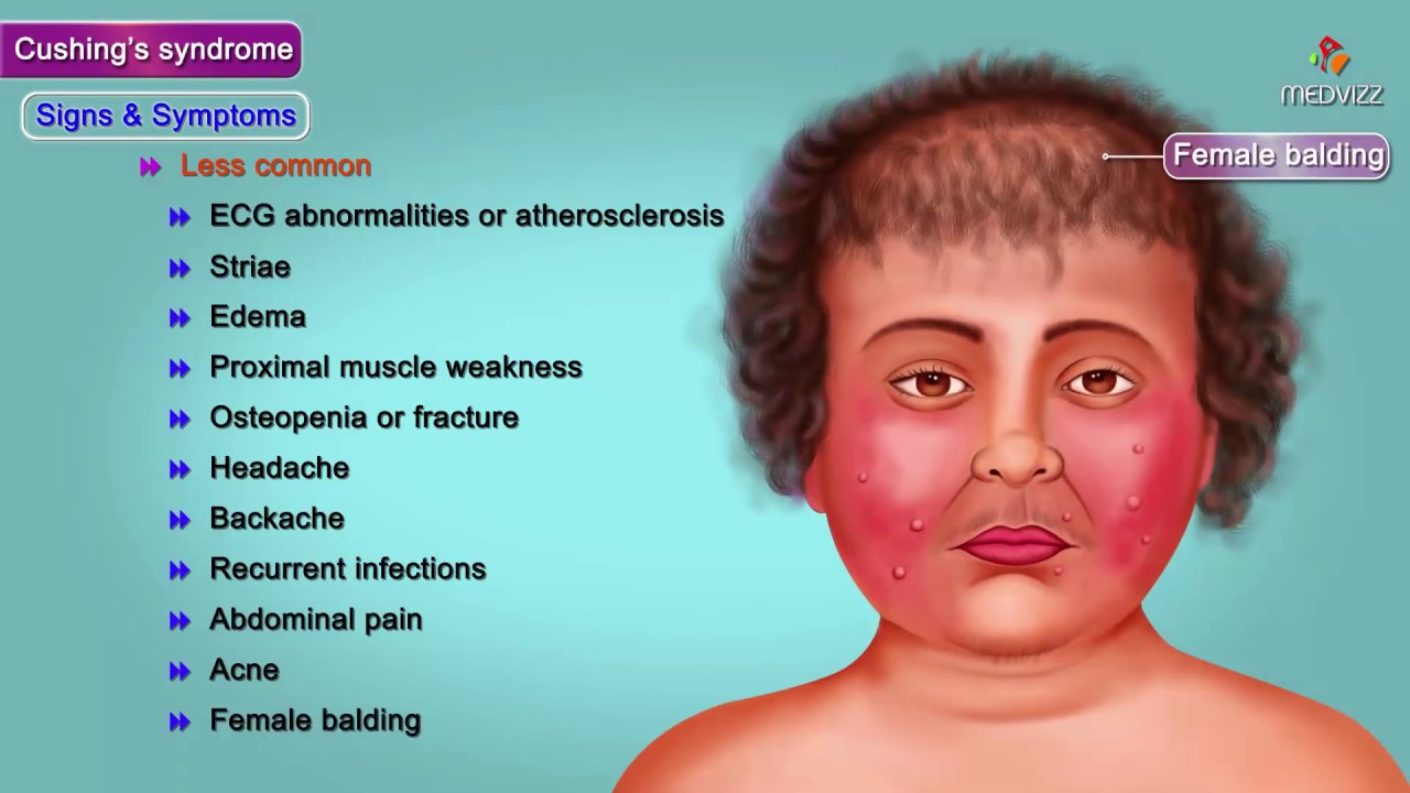 syndrome cushing symptôme - syndrome de cushing diagnostic