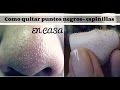 How to remove pimples (black spots)
