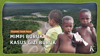 Anak-anak di Asmat Papua Tinggalkan Sagu dan Mulai Ketagihan Mi Instan