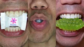 Satisfying ASMR | Gracias Candy, Super Soda Candy & Green Bumpy Gummy