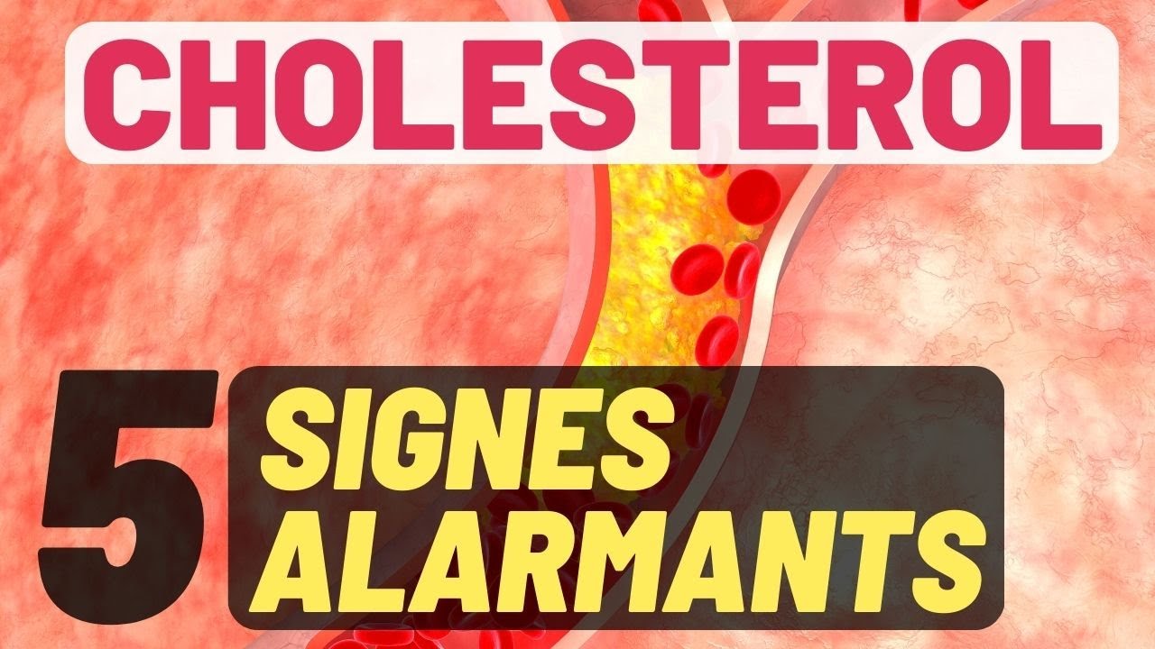 CHOLESTÉROL : 5 Signes Qui Doivent Vous Alerter ! - YouTube