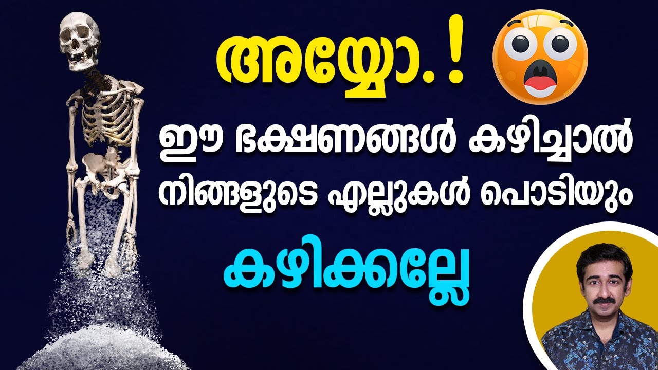 അയ്യോ.... ഈ ഭക്ഷണങ്ങൾ കഴിച്ചാൽ നിങ്ങളുടെ എല്ലുകൾ പൊടിയും... കഴിക്കല്ലേ