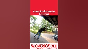 Acceleration Deceleration Concussion Courtesy of Skateboarding