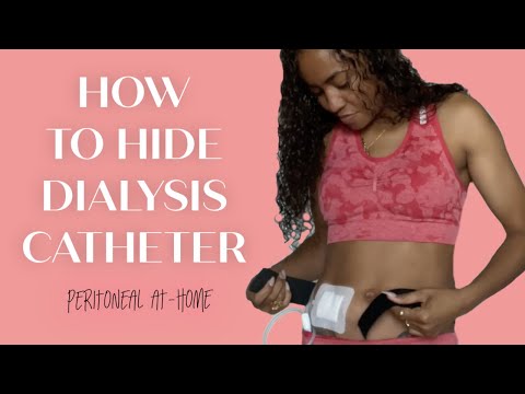 Hiding and Securing your Dialysis Catheter