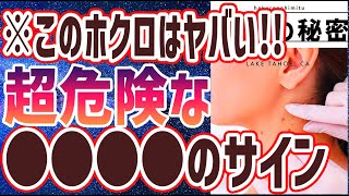 【ベストセラー】「こんなほくろに要注意！！超意外な皮膚がんの特徴5選」を世界一わかりやすく要約してみた【本要約】