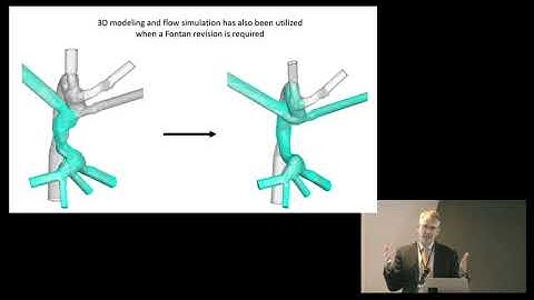 Clinical Applications of 3D Models and Computational Flow Dynamics for Preoperative Planning