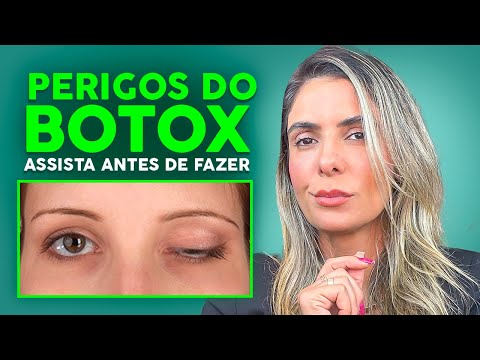 O que pode dar ERRADO na APLICAÇÃO de BOTOX? Quais as COMPLICAÇÕES do BOTOX?