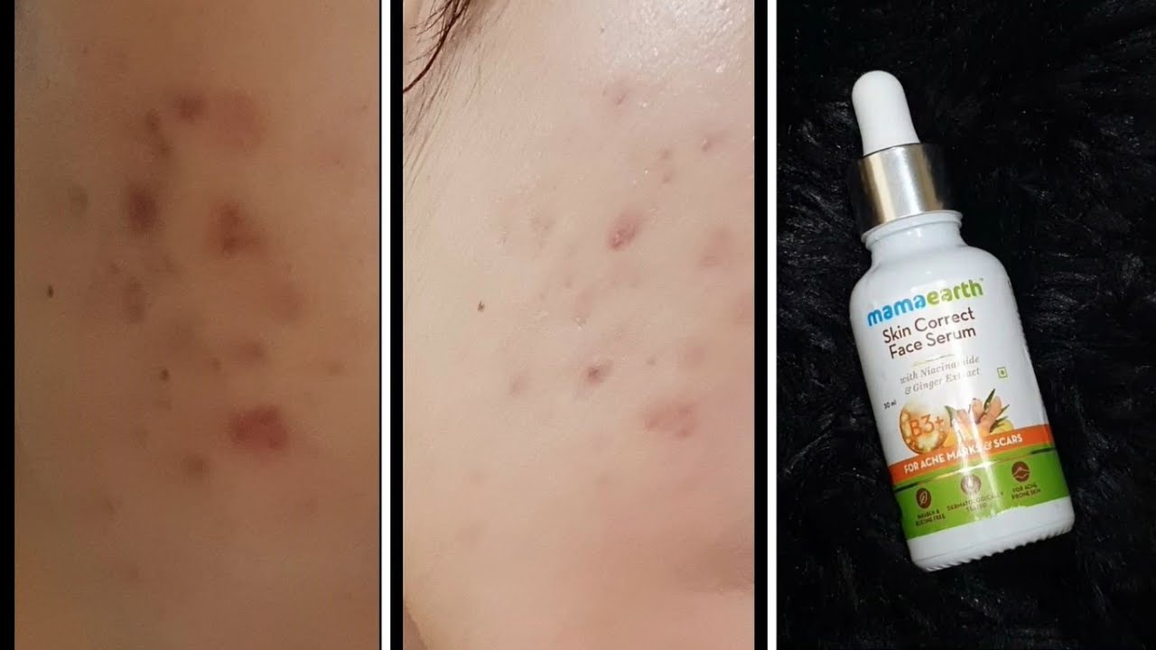 Download The Face Shop Baby Face Ampoule Sleep Mask Korean Skincare Review Demo Is It Worth It Youtube PSD Mockup Templates