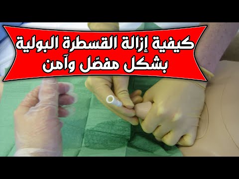 فيديو: 3 طرق لفك القسطرة