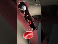 Micro vascular Decompression Surgery (3D animation) #motivation #motivation