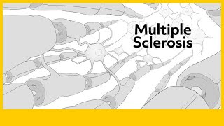 Multiple Sclerosis