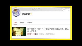 這個部位長腫塊，變成羞於檢查的「癌」？