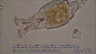 Rotifers under the microscope