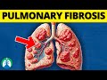 Pulmonary Fibrosis (Medical Definition) | Quick Explainer Video