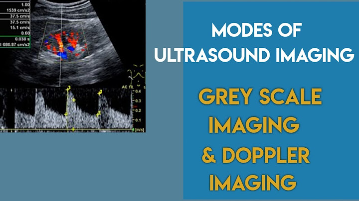 A mode b mode m mode ultrasound là gì