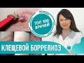 Болезнь Лайма: симптомы, лечение антибиотиками. Клещевой боррелиоз, Лайм-боррелиоз после укуса клеща