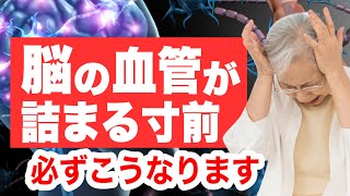 脳の血管が詰まる寸前の人にだけ現れる症状と予防法