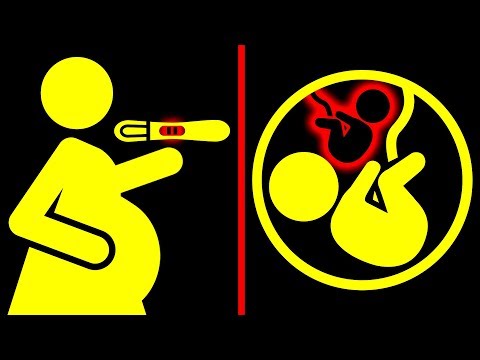 Vídeo: ¿Puedes Quedar Embarazada Mientras Estás Embarazada? Es Raro Pero Posible