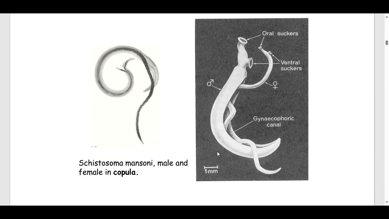 Schistosoma mansoni ||Helminths || parasitology 
