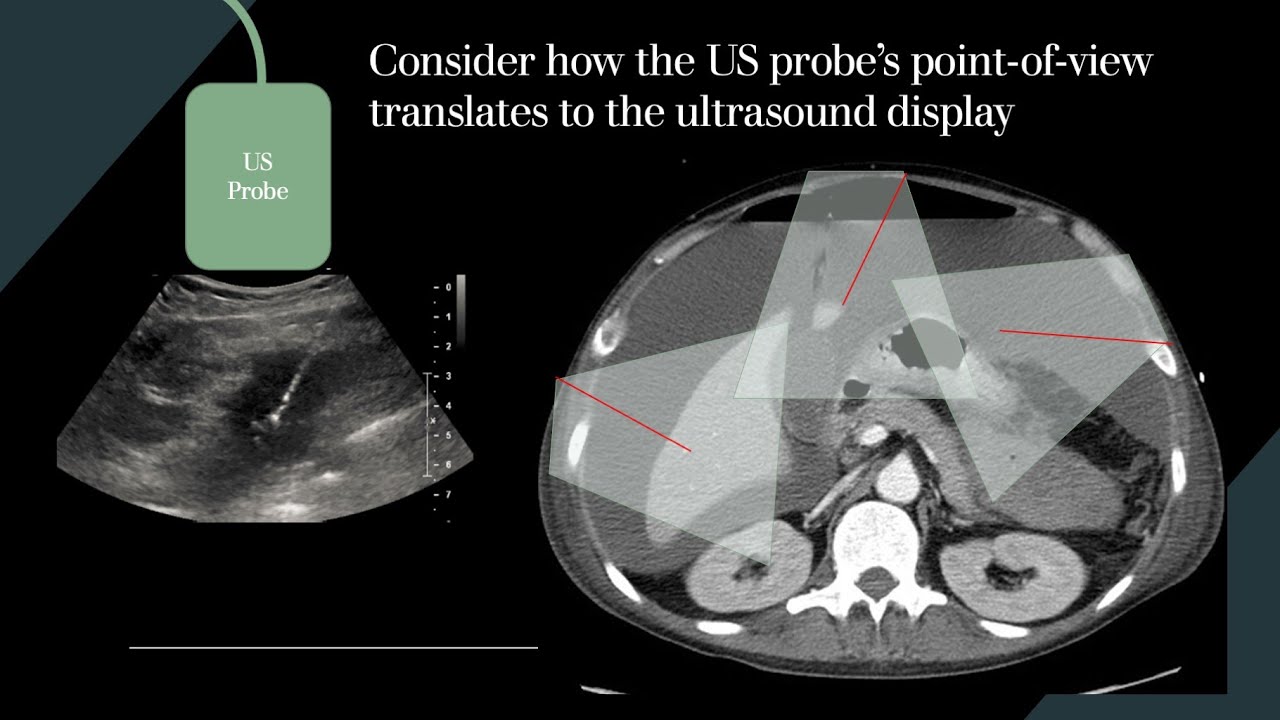 Mastering US guided procedures: Dr. Paul Shyn and Dr. Dan Souza