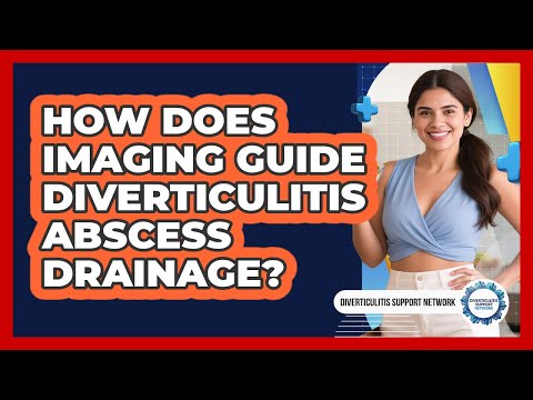 How Does Imaging Guide Diverticulitis Abscess Drainage? - Diverticulitis Support Network