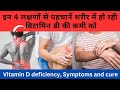इन 4 लक्षणों से पहचानें विटामिन डी की कमी को|Signs of Vitamin D deficiency| ऐसे बढा़यें vitamin D को