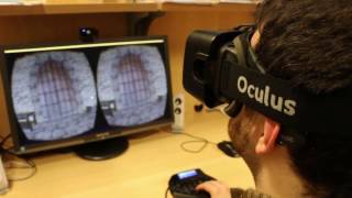 GLASSBRAIN