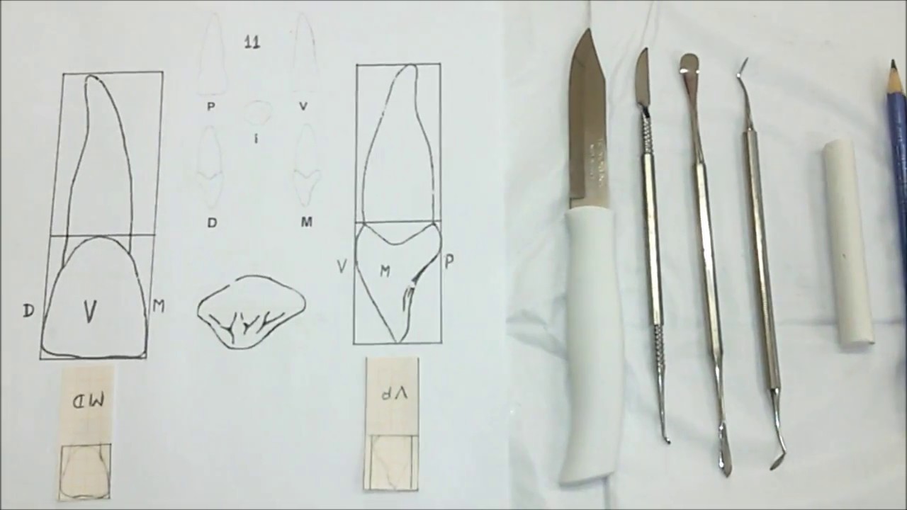 Escultura Dental  Incisivo (11)