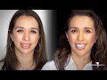 Mom Gets Incredibil™ Cosmetic Makeover! Total Transformation by Brighter Image Lab!