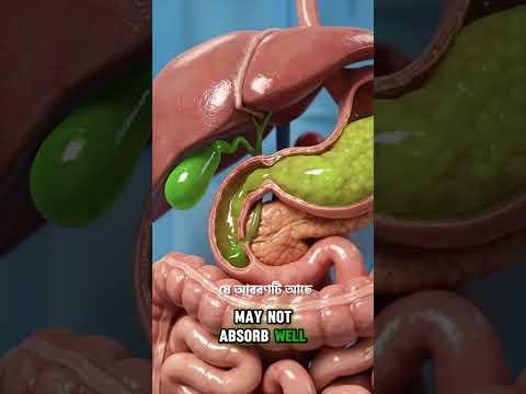 পিত্তথলির পাথর কি শক-ওয়েভে গলে? 🛑 | Gallbladder vs Kidney Stone | Dr. M Arefin #shortsvideo