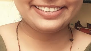 ludo live #dailyludolive#game#ludoking screenshot 3