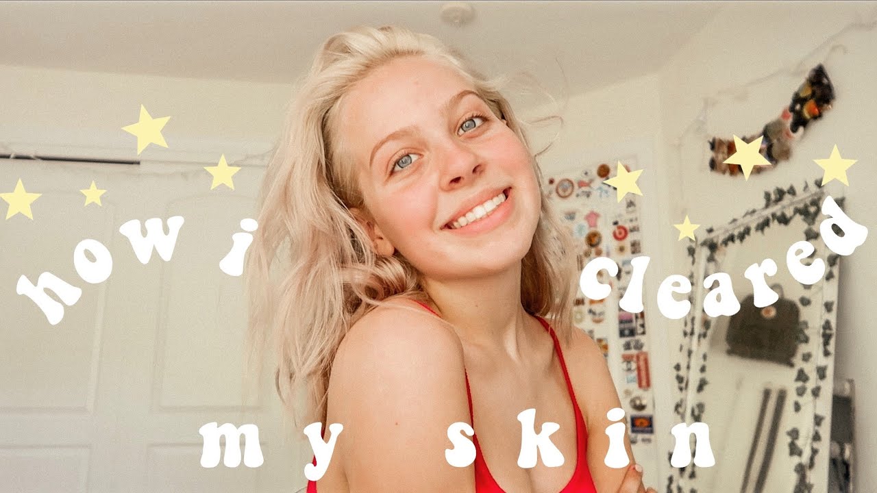 how i got clear skin - YouTube