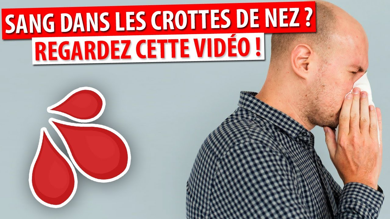 SANTÉ DU SANG DANS VOS CROTTES DE NEZ ? VOUS