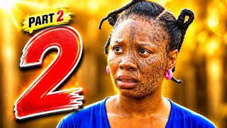 WAZAZI WAKE WALIMKATAA NA KUMDHARAU KISA KOVU LAKE USONI MWISHO UTAKUTOA CHOZI |Movie recap swahili.